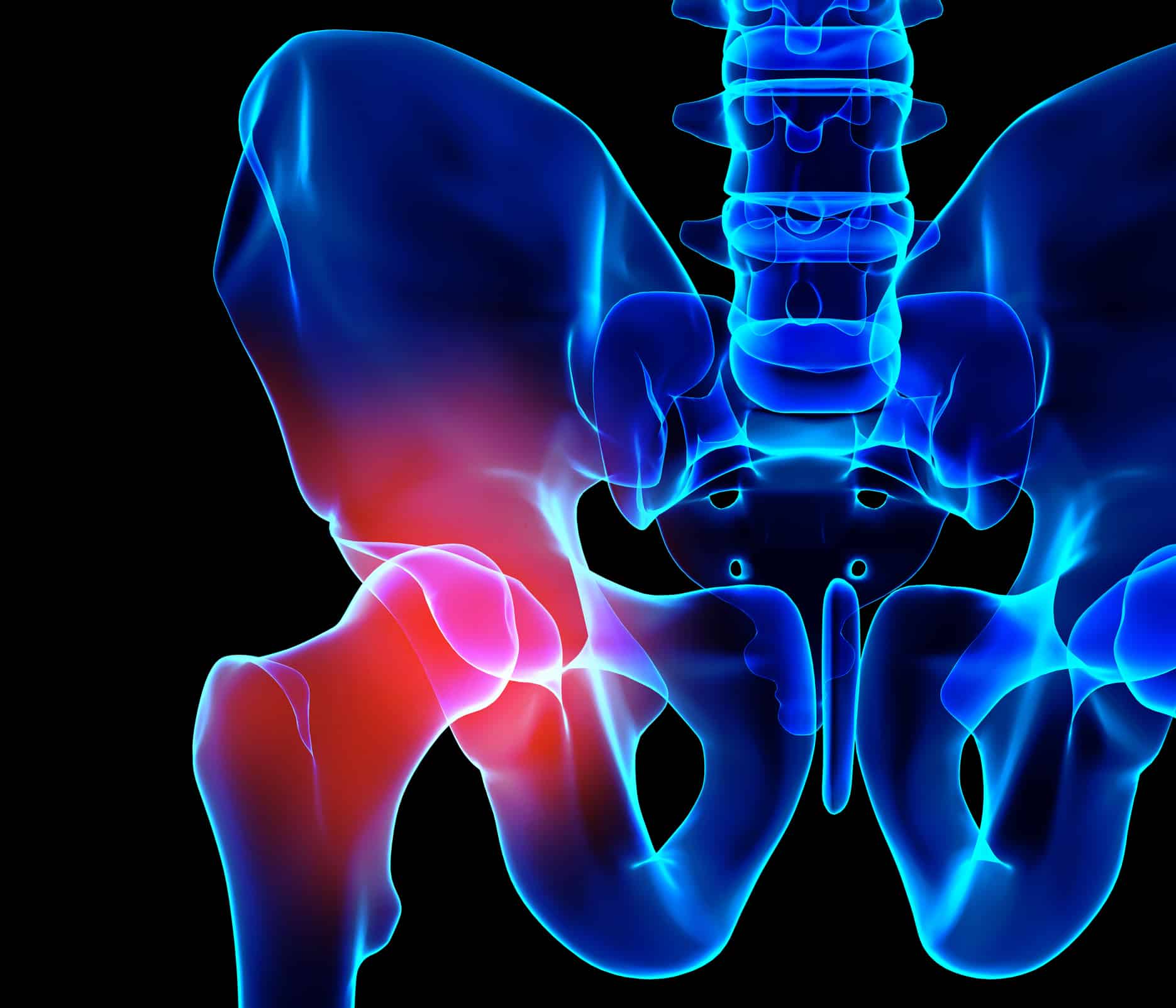 Partial Hip Replacement Video