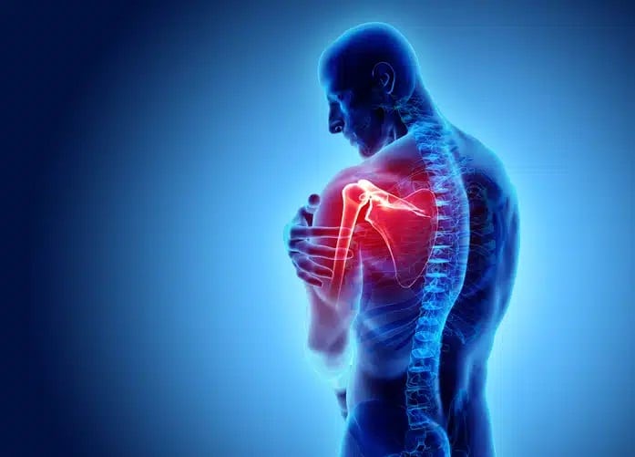 Rotator Cuff Tear Symptoms