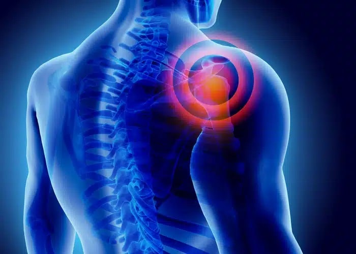 Shoulder Pain Relief Shoreline