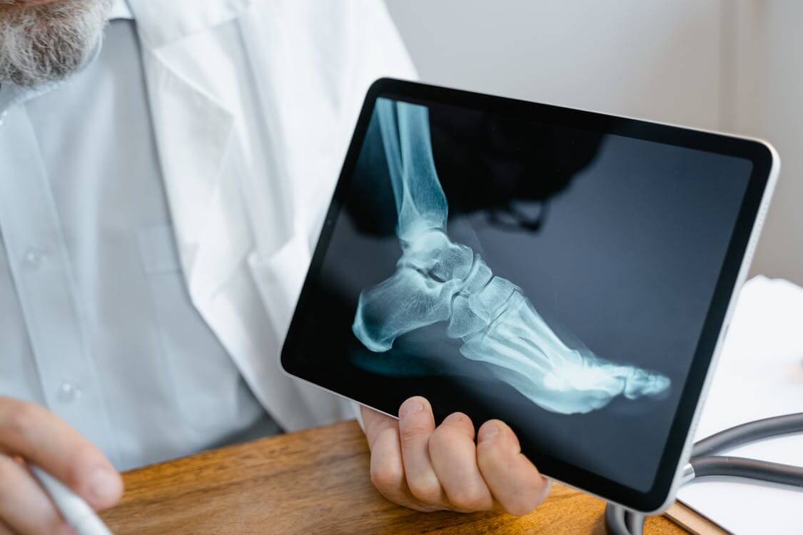 What is Orthopedic Impairment