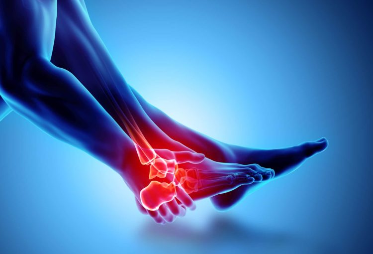 Ankle Sprain Recovery