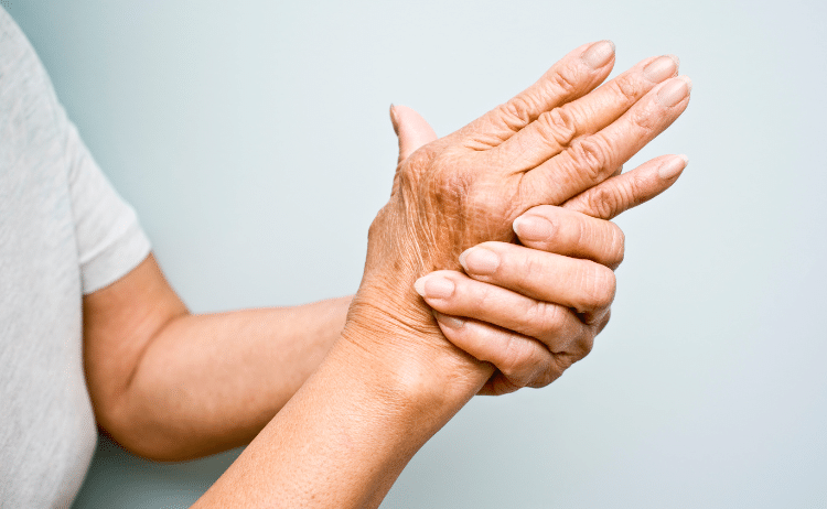 Rheumatoid Arthritis Treatment - Northgate