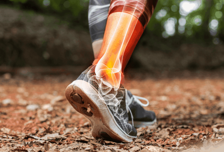 Common Sports Injuries