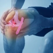 Can an ACL Tear Heal Without Surgery?