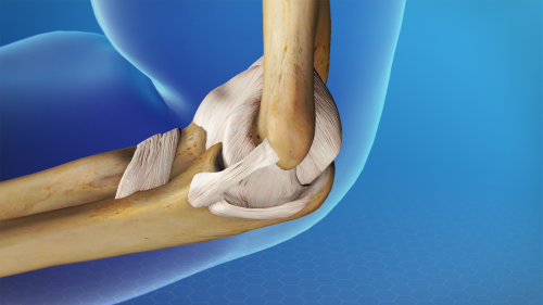 uclinjury2